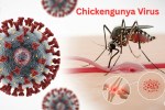 Chikungunya is transmitted by Mosquitoes