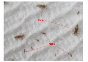 Head Lice and&nbsp;Back-to-School